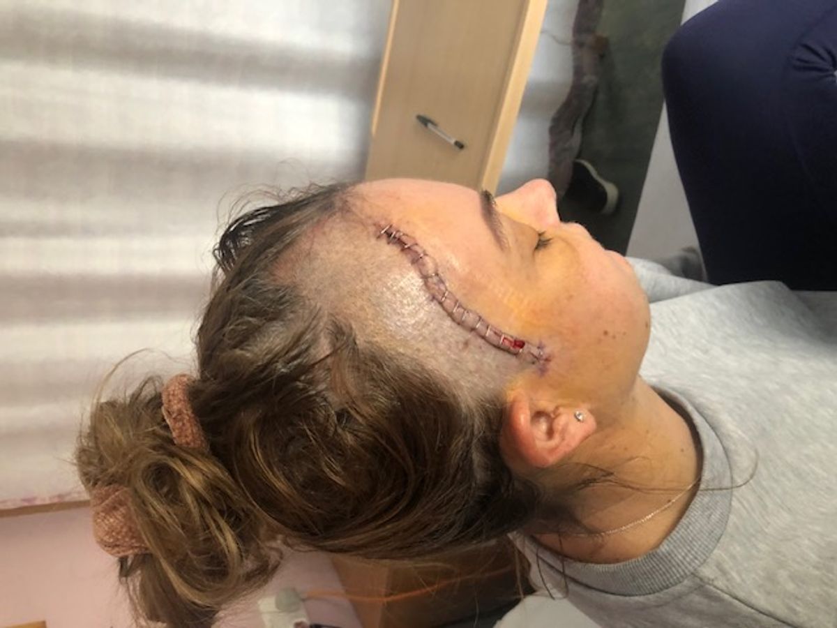 Tammy Croston after surgery