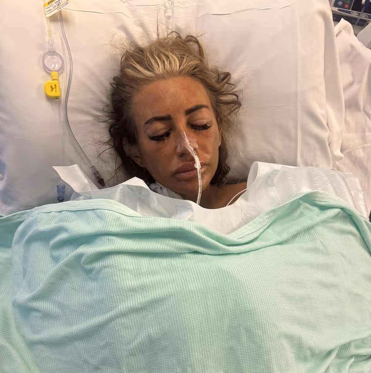 Cydnie recovering in hospital bed after surgery