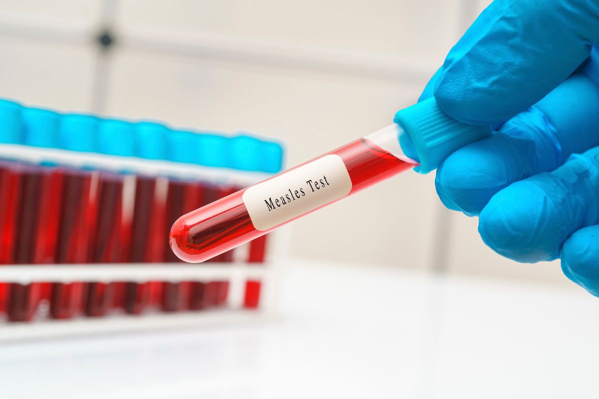 Measles blood test, conceptual image.