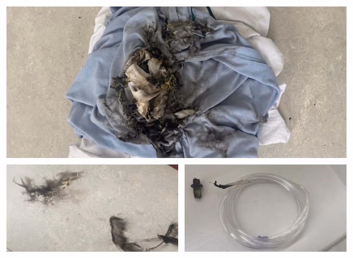 Fire damage to an oxygen mask, bedsheets and the floor at Sunderland Royal Hospital