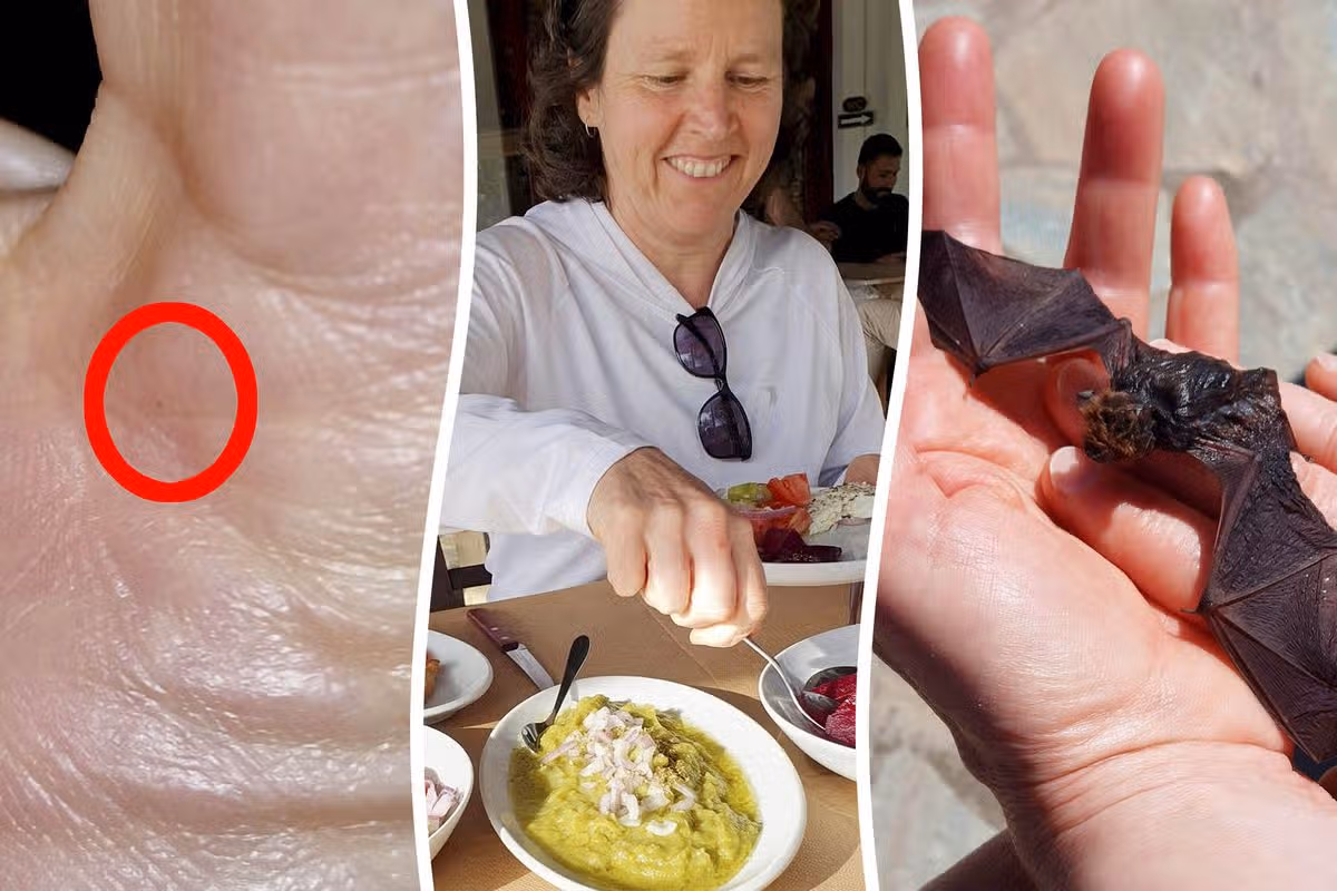 Laura Horton, 53, was bitten by the bat she rescued from the swimming pool