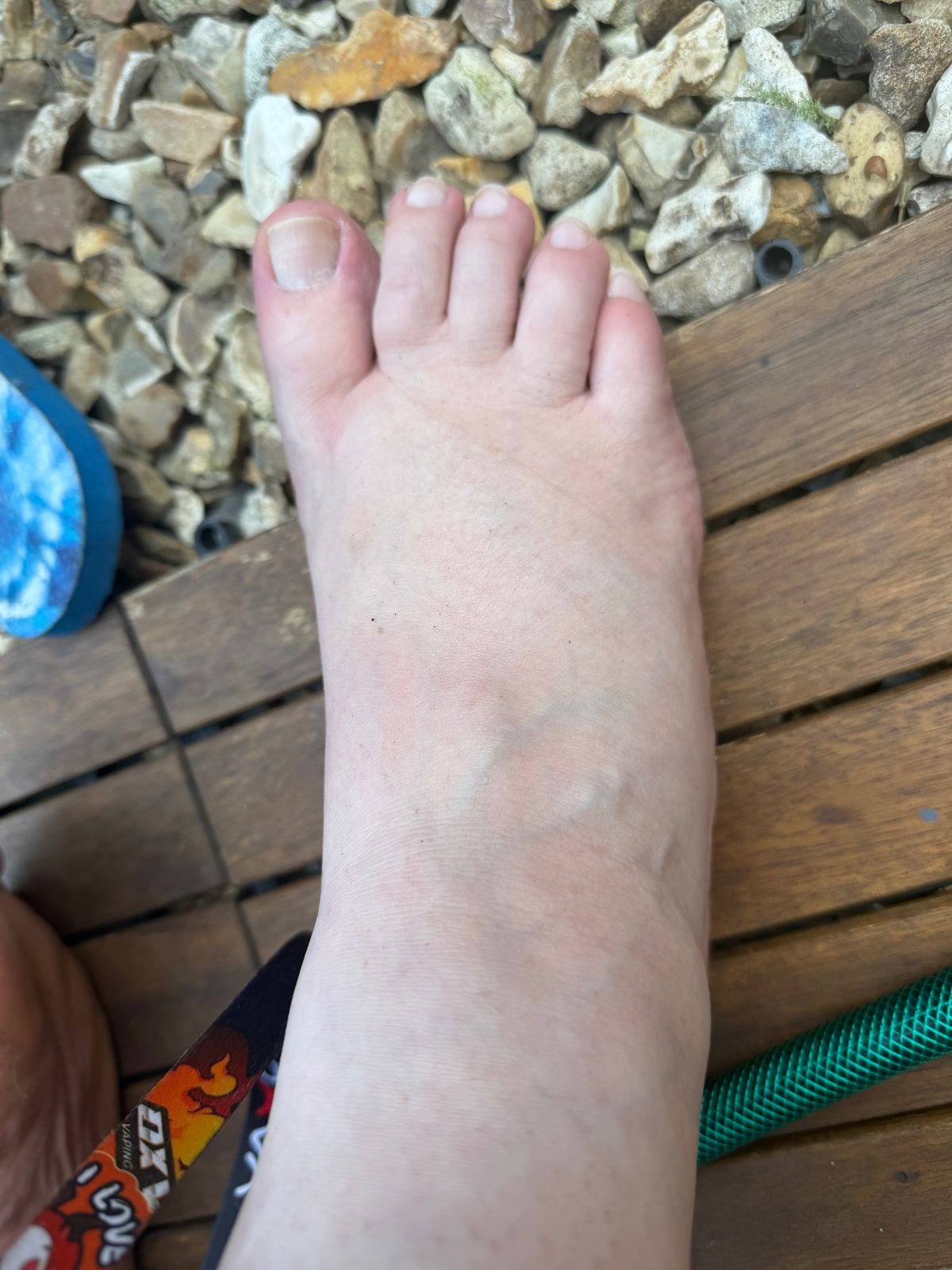A photo of Elisha's foot