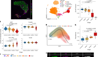 Imaging mass cytometry reveals functional and immunological changes during type 1 diabetes progression in human pancreata