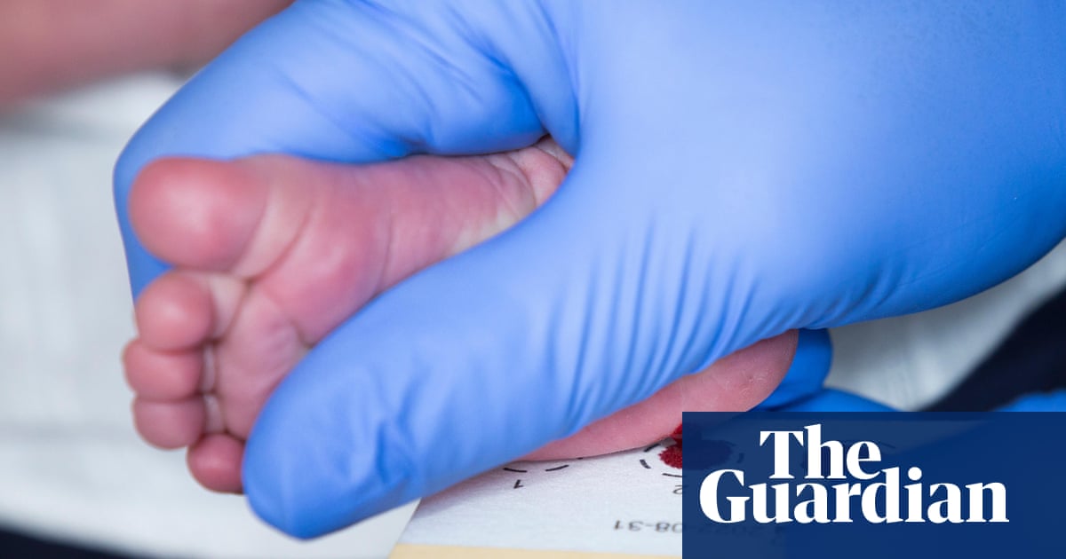 All newborns in England to be screened for spinal muscular atrophy from 2027 | Health