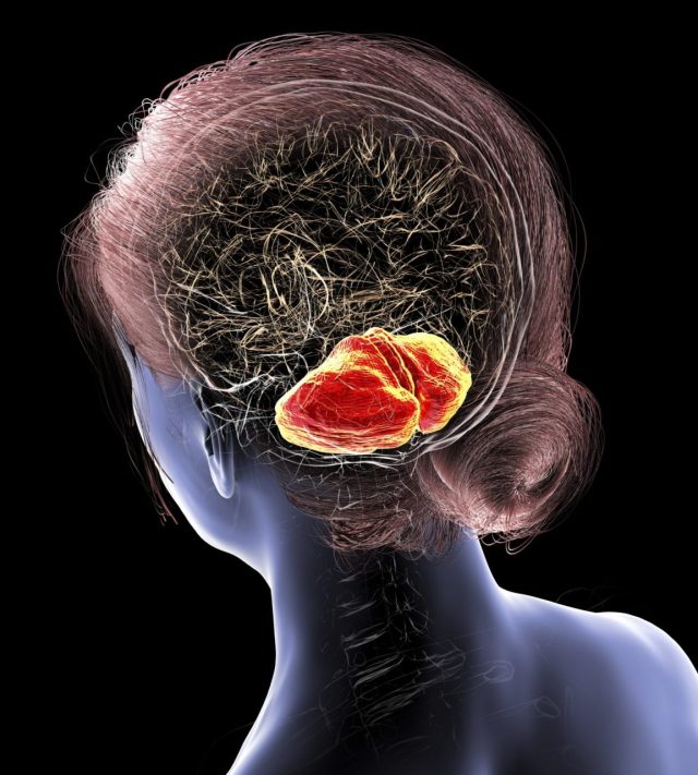 Illustration of the human brain with highlighted cerebellum. This responsible for coordination, balance, and fine motor control. It is damaged in ataxia and neurodegenerative disorders