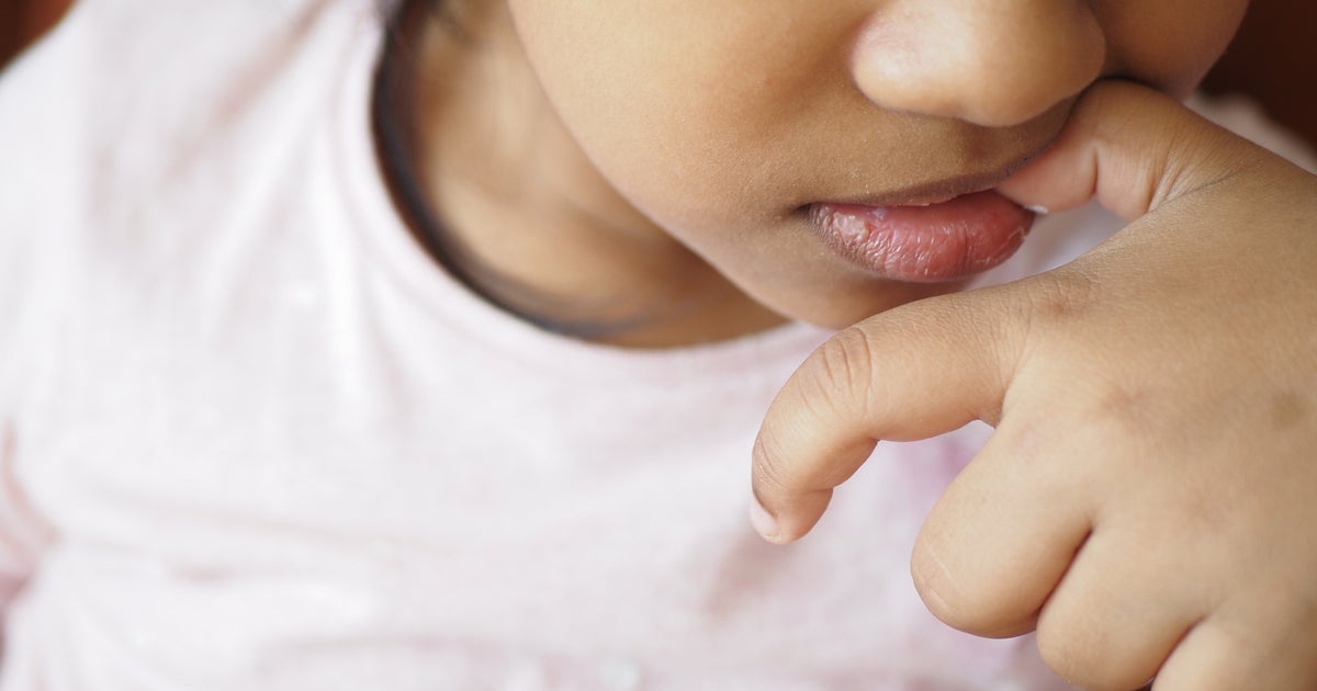 The Physical Signs That Commonly Show Up In Kids With ADHD