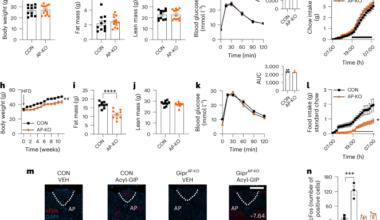 Distinct brain regions mediate regulation of food intake in response to GIPR agonism or antagonism