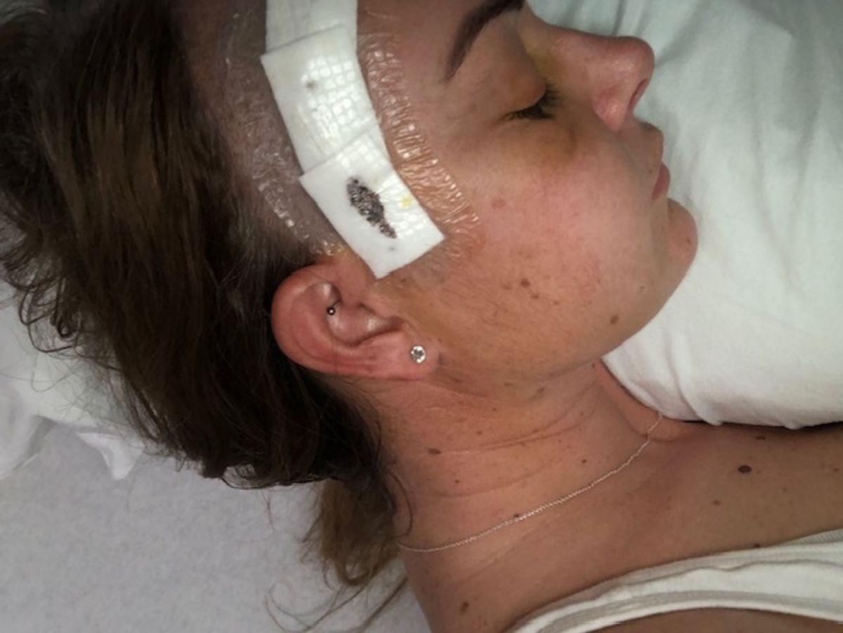 Tammy Croston was left without the use of one of her eyes after surgery to remove her tumour went wrong