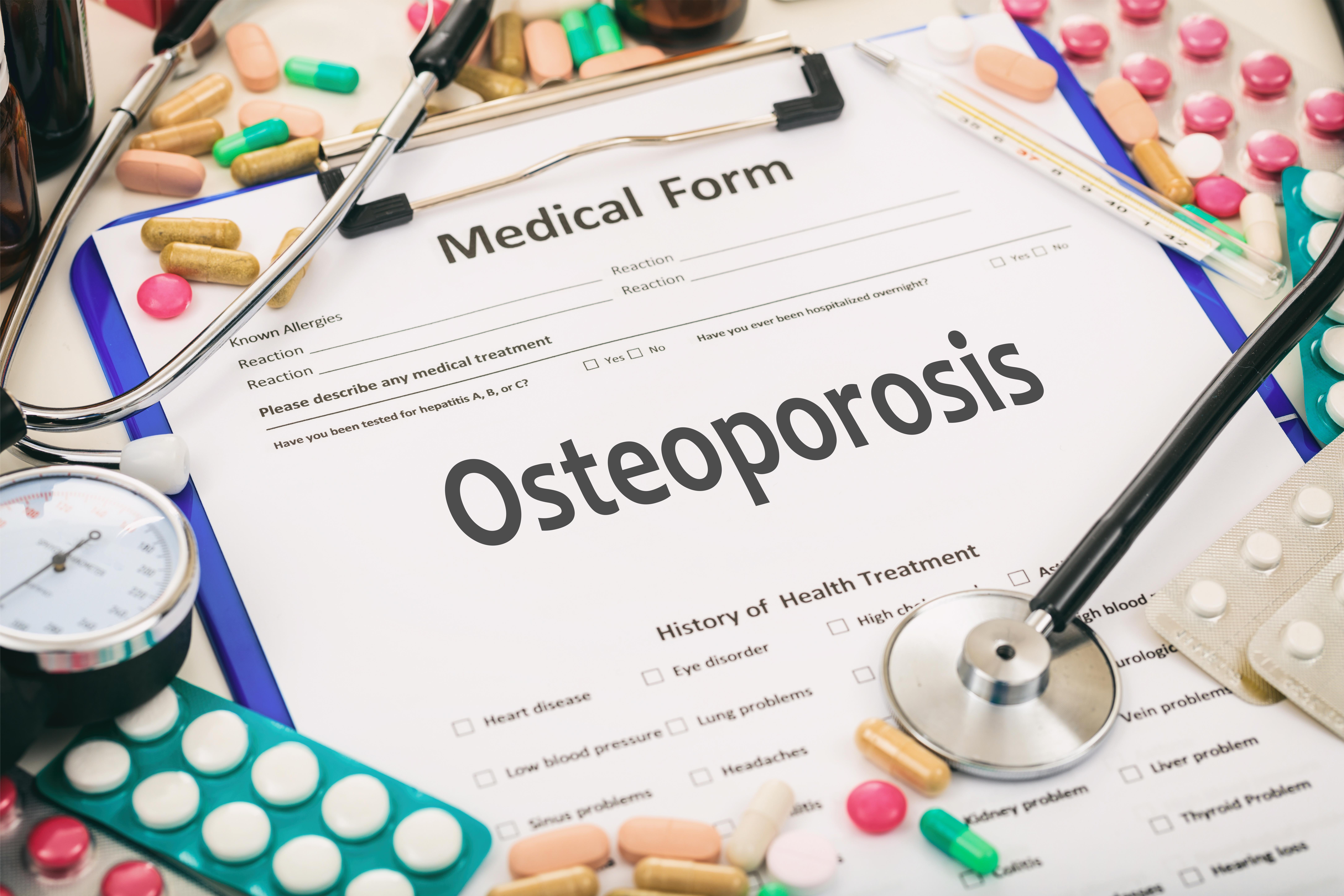 ‘As we get older our bones can get weaker, but when they become fragile this can lead to a condition called osteoporosis. People living with osteoporosis can break a bone from a relatively minor fall or accident.’