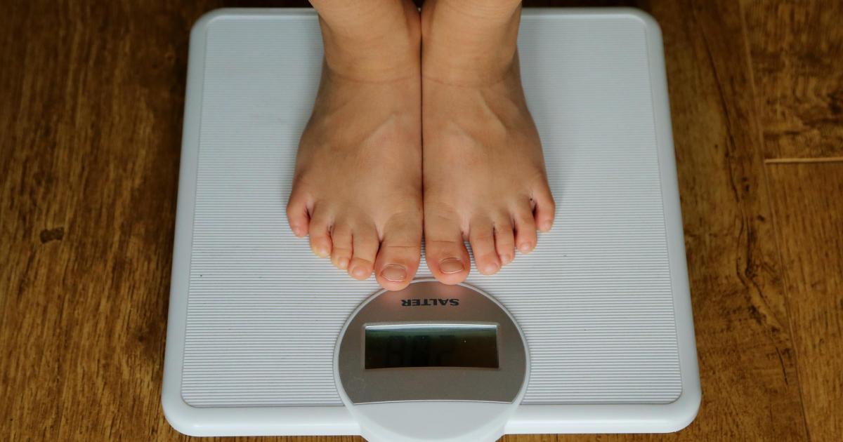 NHS Dorset secured funding for new obesity care programme