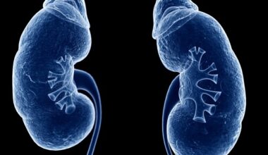 Medical breakthrough allows kidney transplant for patient with zero options