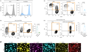 Derivation of functional retinal endothelial cells from human pluripotent stem cells for therapeutics and modelling