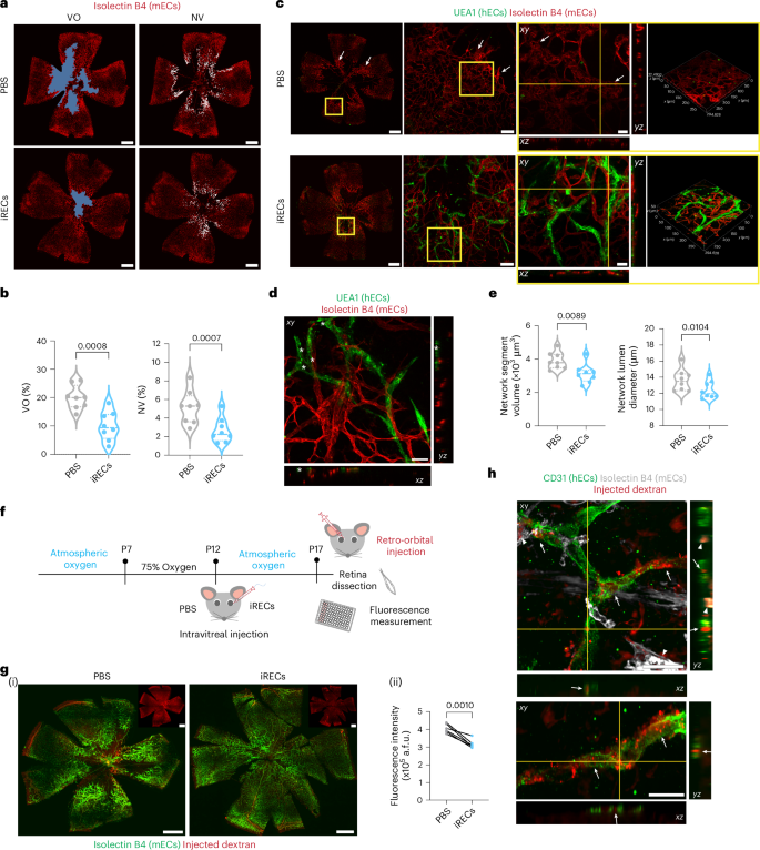 Fig. 4: iRECs revascularize the ischaemic eye.