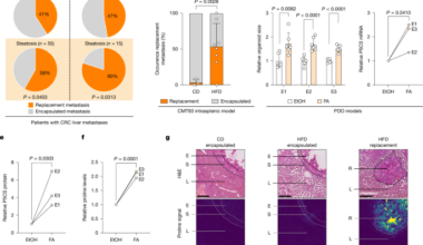 Steatosis shapes prognosis-defining liver metastasis heterogeneity in CRC