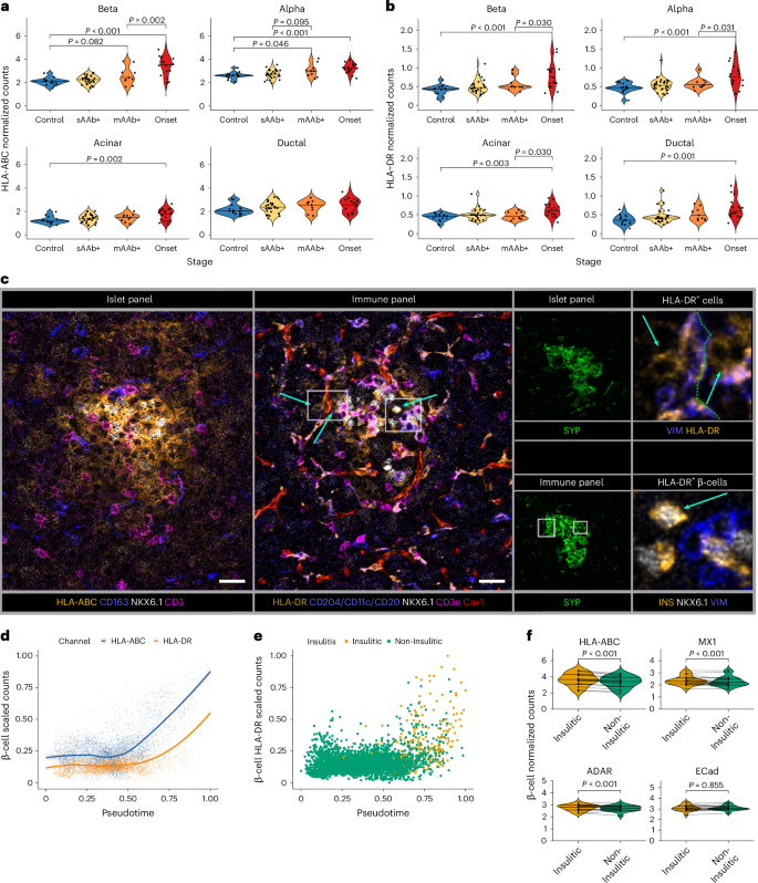 Fig. 2: IFN-dependent MHC-II upregulation in β-cells and other pancreatic cells.