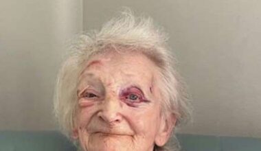 Daughter's horror after finding mum covered in bruises at UK care home | UK | News