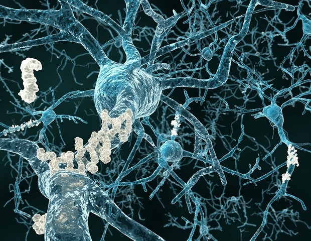 SuperAgers retain exceptional memory through mechanisms beyond genetics