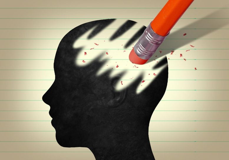 Brain Dementia Erasure Alzheimer's