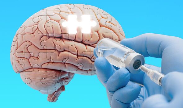 Alzheimer disease, Asian doctor holding brain anatomy model for study diagnosis and treatment in hospital. Alzheimer disease, Asian doctor holding brain anatomy model for study diagnosis and treatment in hospital.