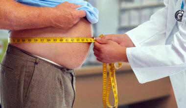 Doctor Measuring Waist Obese Man