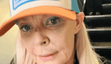 Gail Porter reveals badly bruised face after getting 'knocked over' in Tube station - London Evening Standard