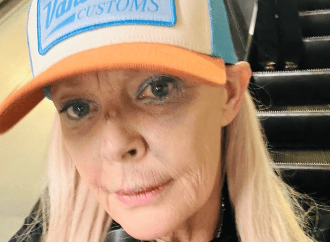Gail Porter reveals badly bruised face after getting 'knocked over' in Tube station - London Evening Standard
