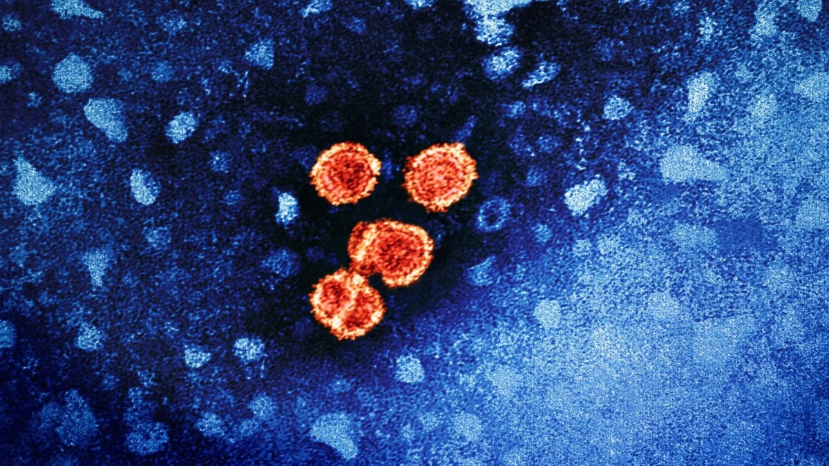 'Footprint of Death': Entirely New Way Viruses Spread Has Been Discovered : ScienceAlert
