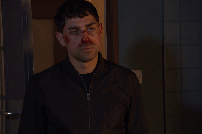 Hollyoaks Summer trailer (2) Jenson with a bloodied face in a scene from Hollyoaks