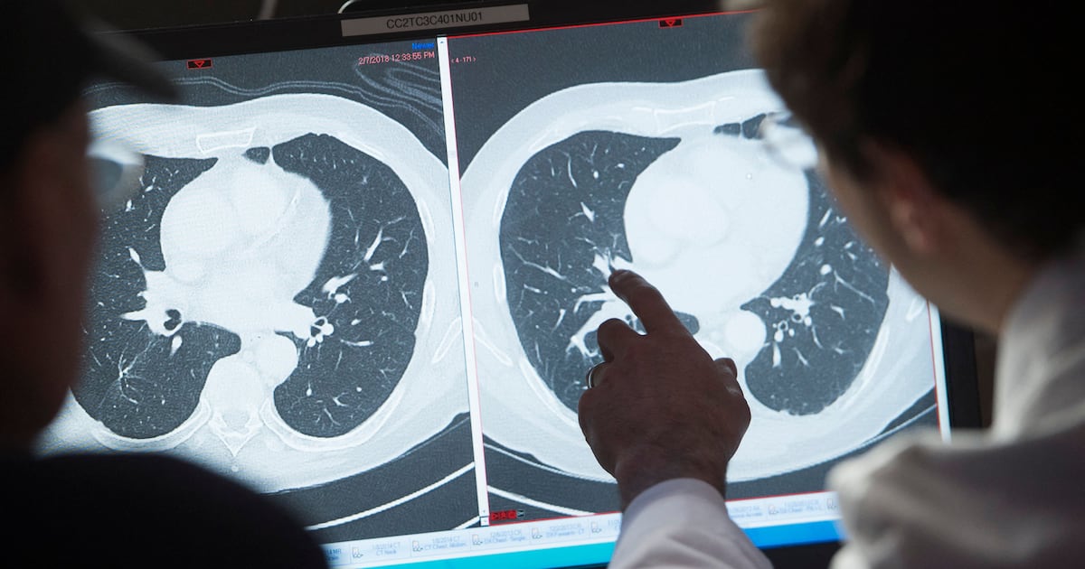 Patients warned off using AI chatbots for self-diagnosis as flaws revealed