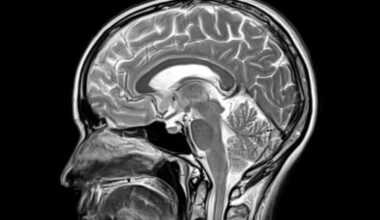 Rare Autopsy Finds Alzheimer's Drugs Only Work in Some Parts of The Brain : ScienceAlert