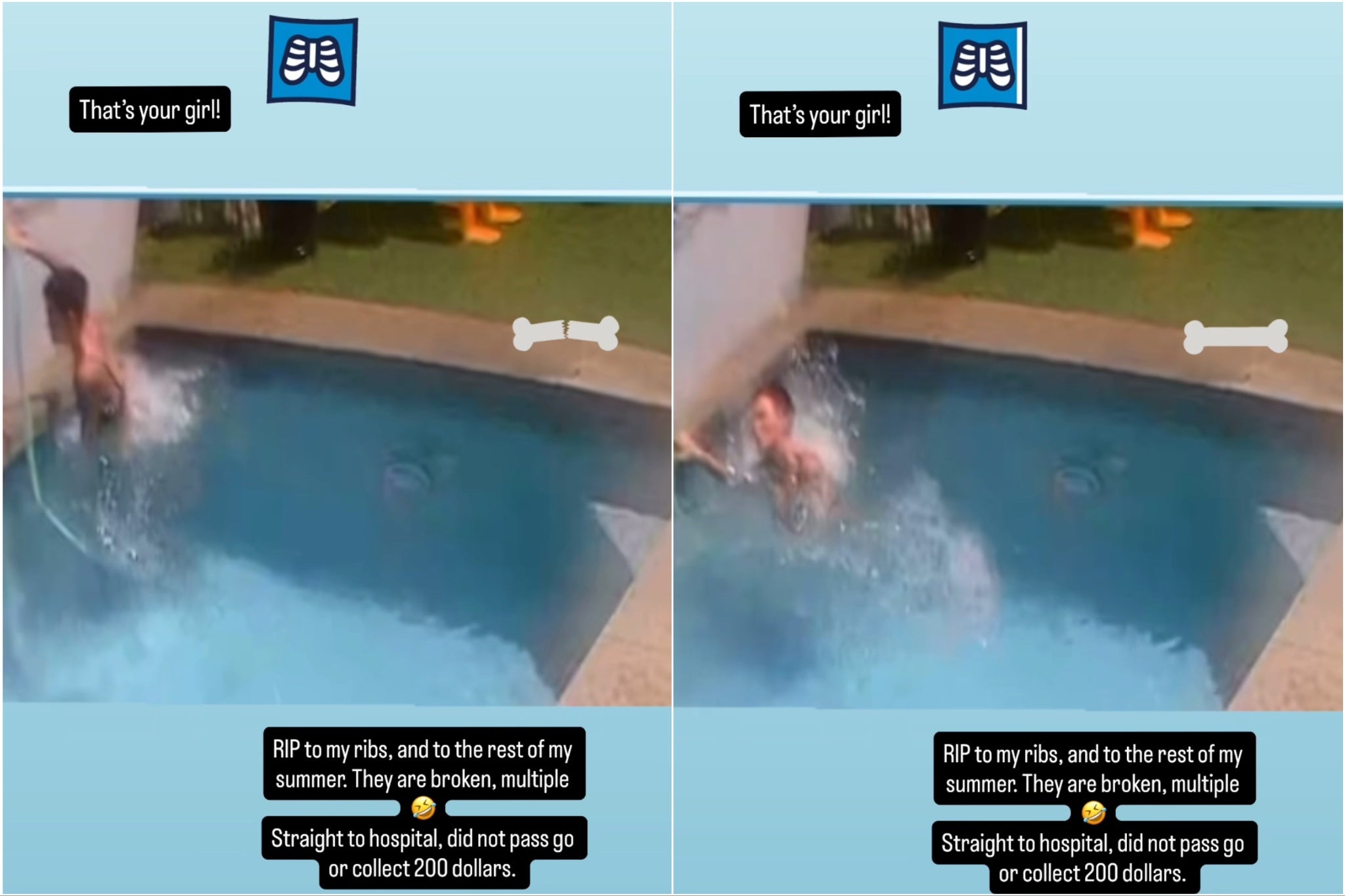 Rose shared footage of her injury on her Instagram Story