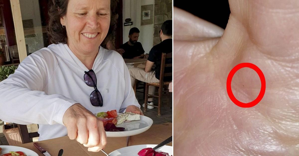 Woman who rescued bat 'saved from rabies' after using Google Lens | News UK