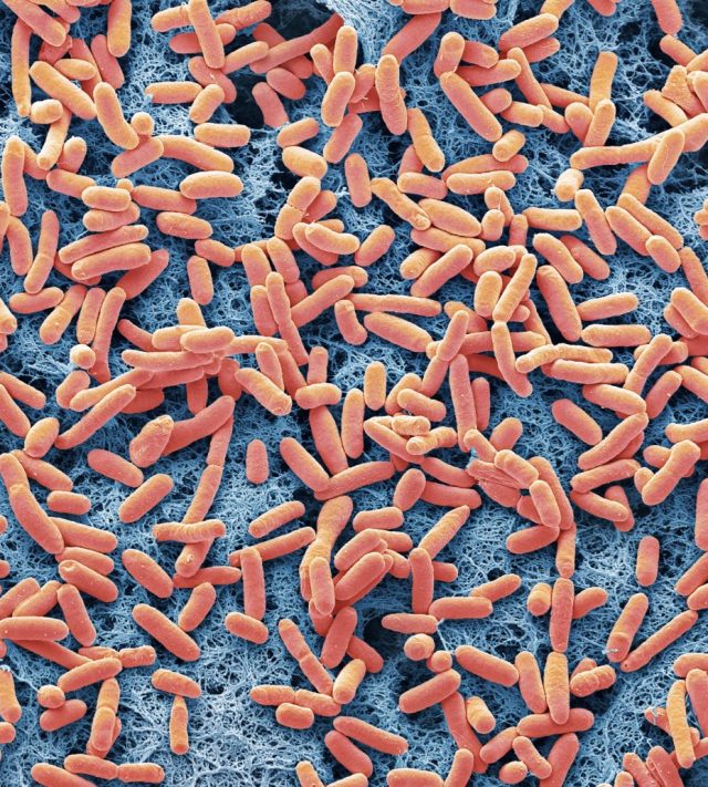 E.coli bacteria. Coloured scanning electron micrograph of the rod-shaped, Gram-negative bacteria Escherichia coli, commonly known as E. coli. These bacteria are normal inhabitants of the human intestine (also animal intestines) and are usually harmless. Under certain conditions E. coli may increase in number and cause infection. Serotypes of E. coli are responsible for gastroenteritis in children, particularly in tropical countries. In adults it is the cause of 'traveller's diarrhoea'; and of 80% of all urinary tract infections. E.coli 0157:H7 can cause additional complications in children and the elderly; renal failure, anaemia, and dehydration especially for children and spontaneous bleeding, organ failure, and mental changes in the elderly. Some of these patients develop permanent disabilities or die. Magnification: x4000 when printed at 10 centimetres wide