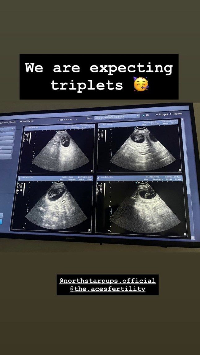 Emmerdale's Lucy Pargeter 'expecting triplets' as she makes unexpected announcement
