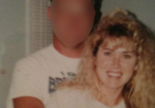 Picture from Kennedy News & Media (PICTURED: A PHOTO OF LISA CHRISTIAN, 61, WHEN SHE WAS YOUNGER SHOWING OFF HER PALE COMPLEXION.) A pale mum who 'tanned to feel pretty' needed such extreme facial reconstruction for a cancerous 'dot' on her nose that she hid i