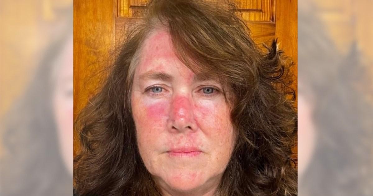 Shocking photos reveal consequences of mum's lifelong tanning obsession