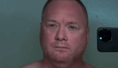 Gruesome side effects of ‘world’s most powerful weight loss drug’ as man shares insane before and after