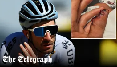 Tour de France cyclist loses part of thumb in crash