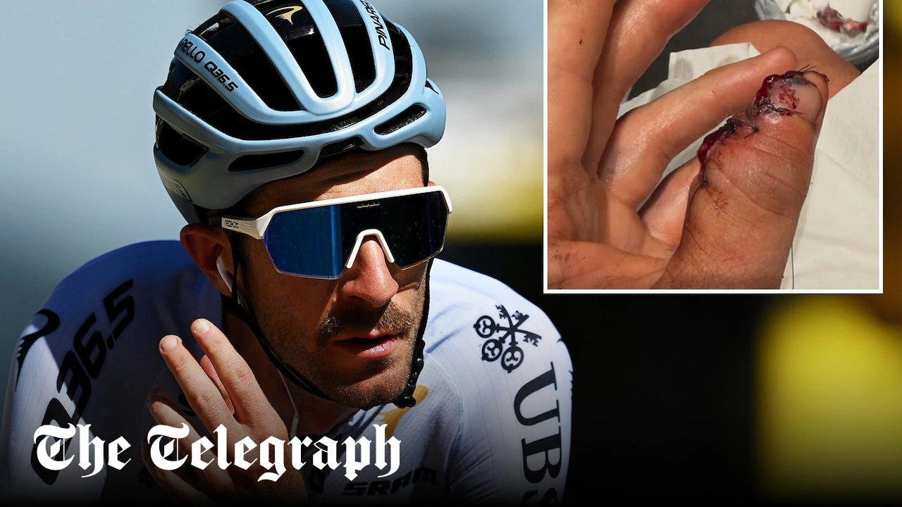Tour de France cyclist loses part of thumb in crash