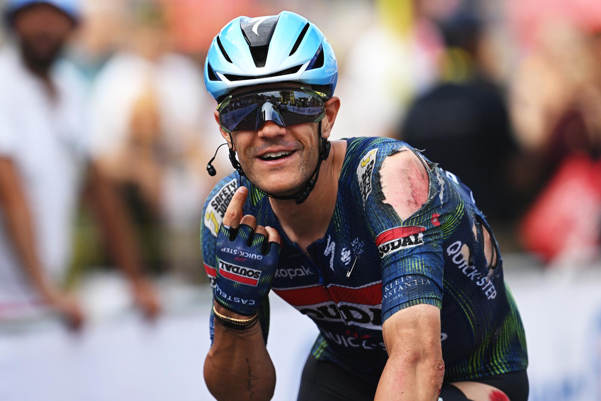 Jasper Stuyven points to himself, covered in grazes after a crash