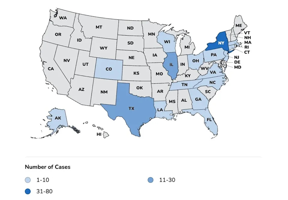 This map from the U.S. Centers for Disease Control and Prevention shows cases of cyclosporiasis in the U.S. as of May 1, 2026. ‘Cyclosporiasis cases may not be limited to these states with known cases. The true number of people sick with cyclosporiasis was likely higher than the number reported,’ the agency says. (CDC)