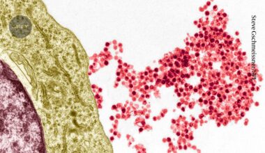 Biologists pinpoint how common virus triggers multiple sclerosis