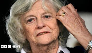 A woman with dark hair pulled back from her face points to a plaster on her arm