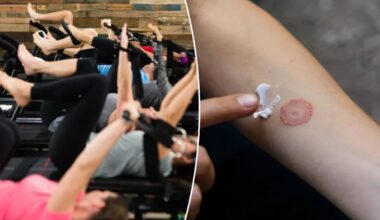 $46-per-class fitness studio is leaving people with ringworm: reports