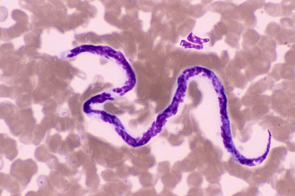 Tapeworm