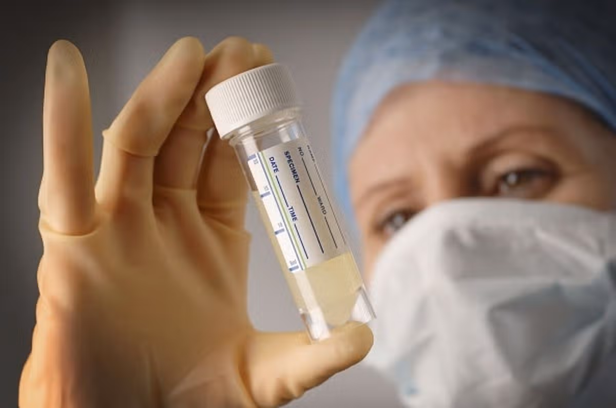 Hospital worker with urine test sample
