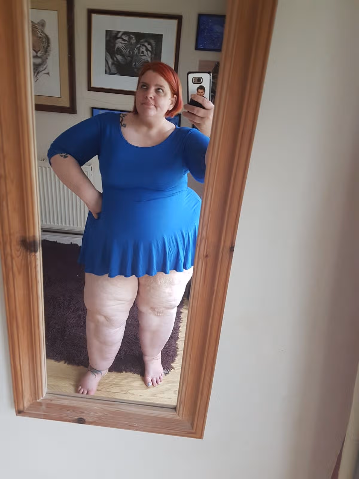 Abigail started gaining weight in her teens