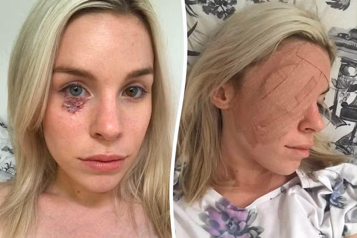 Jessica 'thought that skin cancer was an older person’s disease'