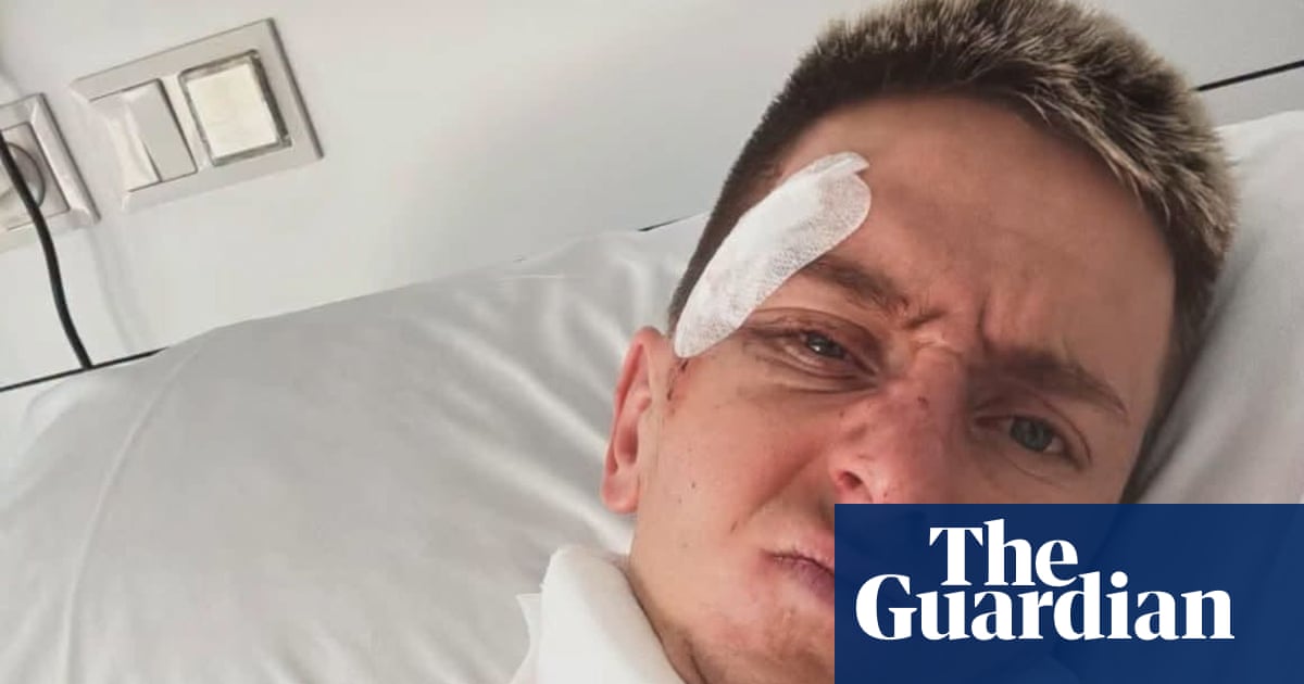 Tadej Pogacar shares picture from hospital after Vuelta-ending crash | Vuelta a España