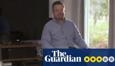 An Amputation Obsession: the Monster and the Surgeon review – an engrossing story, if you can stomach it | Television
